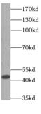 Aspartate aminotransferase, cytoplasmic antibody, FNab03568, FineTest, Western Blot image 