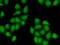 SS18 Subunit Of BAF Chromatin Remodeling Complex antibody, 22-612, ProSci, Immunofluorescence image 