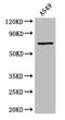 F2 antibody, A58990-100, Epigentek, Western Blot image 