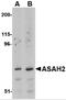 N-Acylsphingosine Amidohydrolase 2 antibody, 4743, ProSci Inc, Western Blot image 