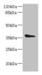 Aminoadipate-Semialdehyde Dehydrogenase-Phosphopantetheinyl Transferase antibody, CSB-PA865121LA01HU, Cusabio, Western Blot image 