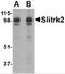 SLIT And NTRK Like Family Member 2 antibody, NBP2-81840, Novus Biologicals, Western Blot image 