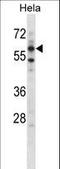 AarF Domain Containing Kinase 5 antibody, LS-C164292, Lifespan Biosciences, Western Blot image 