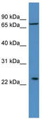 MOB Kinase Activator 3A antibody, TA340258, Origene, Western Blot image 