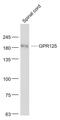 Probable G-protein coupled receptor 125 antibody, GTX51219, GeneTex, Western Blot image 