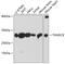 Thioredoxin Domain Containing 9 antibody, GTX66578, GeneTex, Western Blot image 