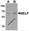 Nasal embryonic luteinizing hormone-releasing hormone factor antibody, 7225, ProSci Inc, Western Blot image 