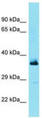 F-Box And Leucine Rich Repeat Protein 15 antibody, TA337308, Origene, Western Blot image 
