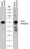 Sonic hedgehog protein antibody, AF464, R&D Systems, Western Blot image 