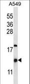 HIG1 Hypoxia Inducible Domain Family Member 2A antibody, LS-C166870, Lifespan Biosciences, Western Blot image 