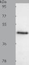 Somatostatin receptor type 5 antibody, TA321265, Origene, Western Blot image 