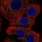 STAT3-interacting protein as a repressor antibody, HPA055050, Atlas Antibodies, Immunofluorescence image 