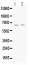 Glutamate Decarboxylase 2 antibody, A03142, Boster Biological Technology, Western Blot image 