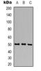 Glutamic--Pyruvic Transaminase 2 antibody, abx133608, Abbexa, Western Blot image 