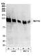 BAF Chromatin Remodeling Complex Subunit BCL11B antibody, NB600-264, Novus Biologicals, Western Blot image 
