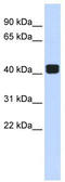 TRIO And F-Actin Binding Protein antibody, TA337911, Origene, Western Blot image 