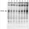 Glycogen Synthase 1 antibody, R1528P, Origene, Western Blot image 