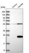 Caspase Recruitment Domain Family Member 19 antibody, HPA010990, Atlas Antibodies, Western Blot image 