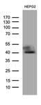 ATPase H+ Transporting V0 Subunit D2 antibody, M08088, Boster Biological Technology, Western Blot image 