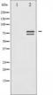 Lamin A/C antibody, TA325628, Origene, Western Blot image 