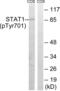 Signal Transducer And Activator Of Transcription 1 antibody, abx012567, Abbexa, Western Blot image 