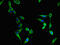 F-Box And Leucine Rich Repeat Protein 22 antibody, CSB-PA757543LA01HU, Cusabio, Immunofluorescence image 