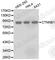 Catenin Beta 1 antibody, A0316, ABclonal Technology, Western Blot image 