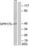 Probable G-protein coupled receptor 173 antibody, TA315517, Origene, Western Blot image 