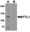 Myelin Transcription Factor 1 Like antibody, TA319841, Origene, Western Blot image 