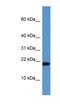 SH2 Domain Containing 1A antibody, NBP1-79810, Novus Biologicals, Western Blot image 