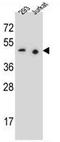 Paired box protein Pax-9 antibody, AP53183PU-N, Origene, Western Blot image 