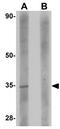 RWD Domain Containing 3 antibody, GTX85246, GeneTex, Western Blot image 