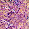 Mitochondrial Ribosomal Protein L17 antibody, LS-C354188, Lifespan Biosciences, Immunohistochemistry paraffin image 