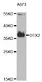 Orthodenticle Homeobox 2 antibody, TA332711, Origene, Western Blot image 