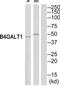Beta-1,4-Galactosyltransferase 1 antibody, TA313920, Origene, Western Blot image 