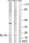 Ribosomal Protein L18 antibody, abx014116, Abbexa, Western Blot image 