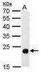 Glutathione S-transferase theta-1 antibody, TA308416, Origene, Western Blot image 