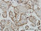 Zinc Finger RANBP2-Type Containing 2 antibody, LS-C133586, Lifespan Biosciences, Immunohistochemistry paraffin image 