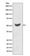Keratin 7 antibody, M02416-2, Boster Biological Technology, Western Blot image 