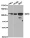 Eukaryotic Translation Elongation Factor 2 antibody, TA327253, Origene, Western Blot image 