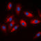 ATP Citrate Lyase antibody, abx133081, Abbexa, Western Blot image 