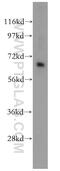 Carnitine O-Acetyltransferase antibody, 15170-1-AP, Proteintech Group, Western Blot image 