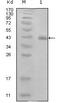 Protein E7 antibody, MA5-15439, Invitrogen Antibodies, Western Blot image 
