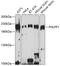 PH Domain And Leucine Rich Repeat Protein Phosphatase 1 antibody, GTX64568, GeneTex, Western Blot image 