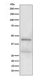 Methyl-CpG-binding domain protein 2 antibody, M01746-2, Boster Biological Technology, Western Blot image 