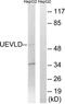 UEV And Lactate/Malate Dehyrogenase Domains antibody, TA315579, Origene, Western Blot image 