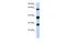 Small nuclear ribonucleoprotein-associated protein B antibody, NBP1-57237, Novus Biologicals, Western Blot image 