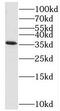 SEC13 Homolog, Nuclear Pore And COPII Coat Complex Component antibody, FNab07677, FineTest, Western Blot image 
