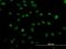Zinc Finger Protein 207 antibody, H00007756-M06, Novus Biologicals, Immunocytochemistry image 