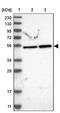 DNA-directed RNA polymerase I subunit RPA49 antibody, PA5-54597, Invitrogen Antibodies, Western Blot image 